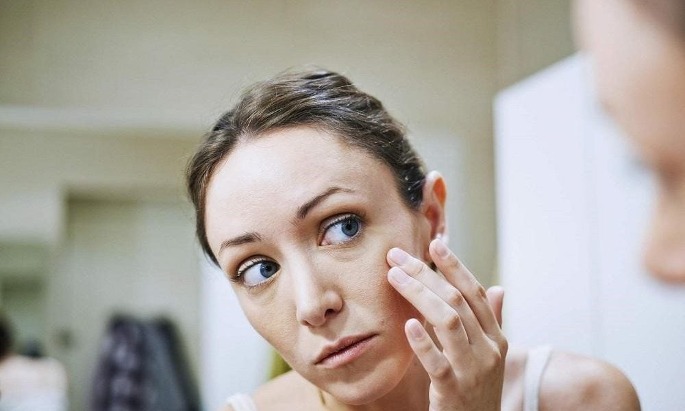 Prevent Acne: 5 Hacks You Need To Know