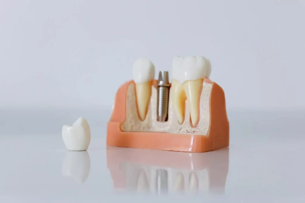 dental