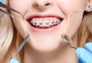 braces