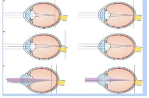 eyes